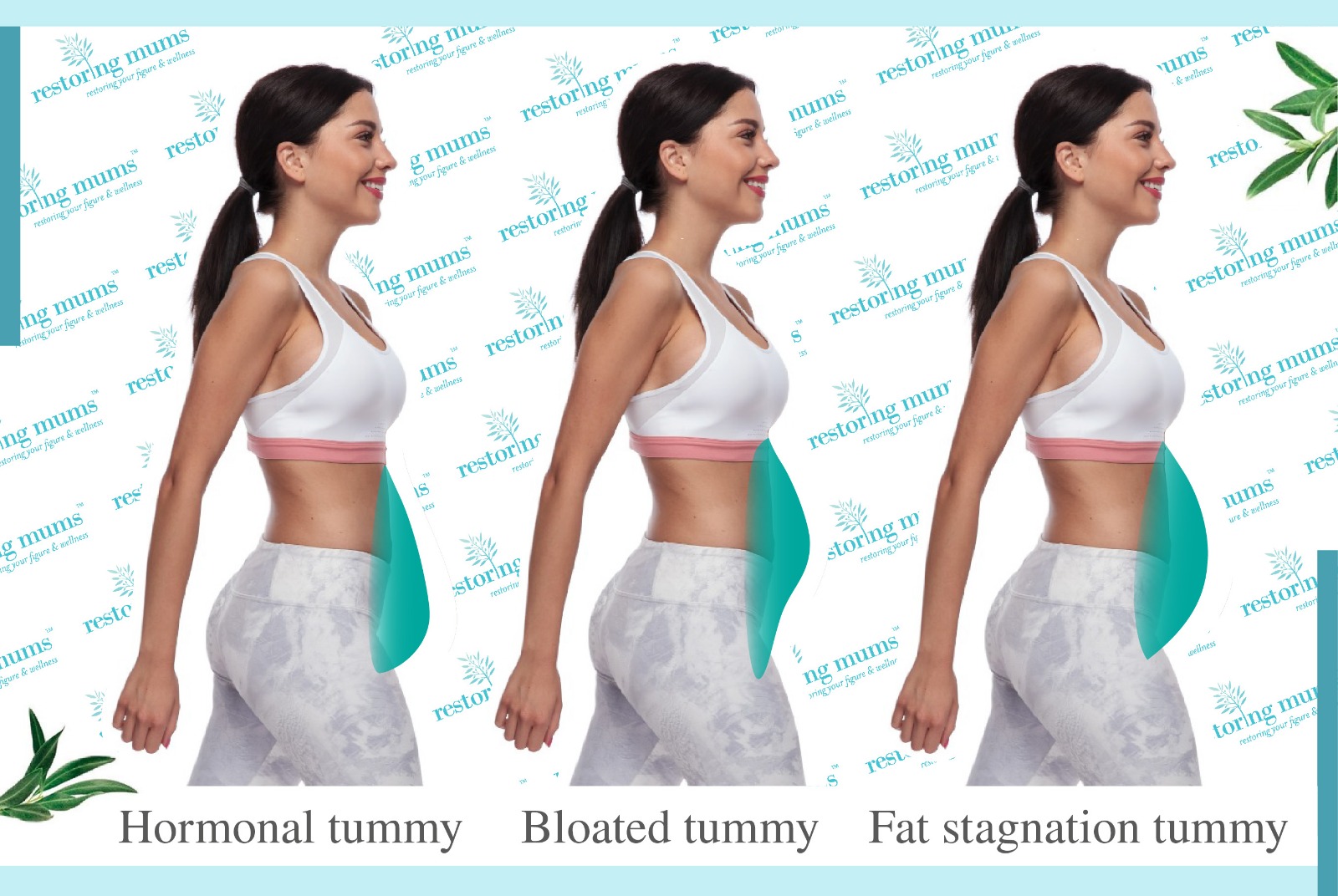 Karen憑多年經驗幾Mummy Tummy分為三大種：肚風型（Bloated Tummy ）、腹部鬆弛型（Laxity of Abdominal Muscle）、脂肪型（Fat），不同肚型要配合不同用料和按摩手法。